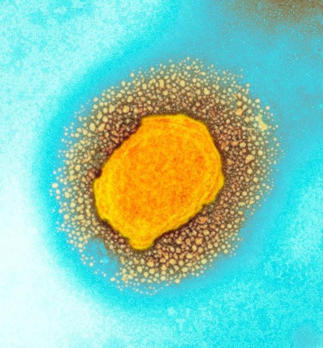 猴痘来袭：猴痘病毒已发生人际传播,猴痘已进化，更具传染性